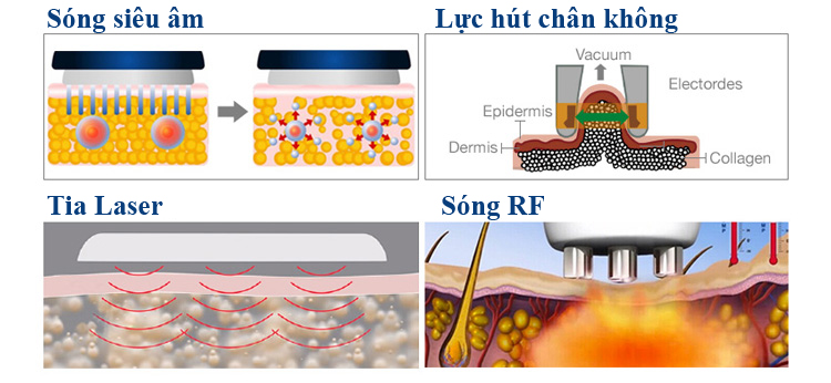 Máy Giảm Béo LS650 Laser Cavitation ☑️ Chính Hãng ☑️ Bảo Hành 18 Tháng