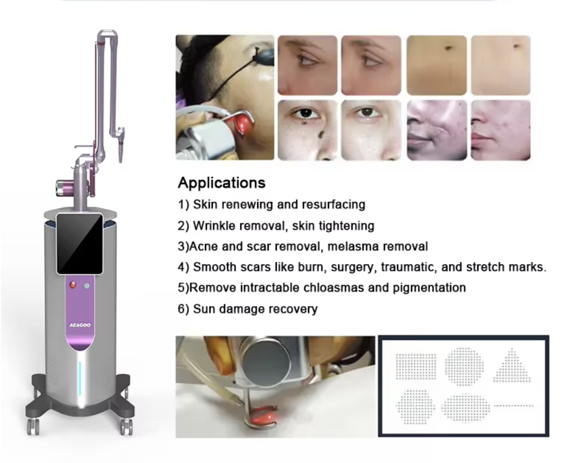 Máy Laser Co2 Fractional AEAGOO Chính Hãng
