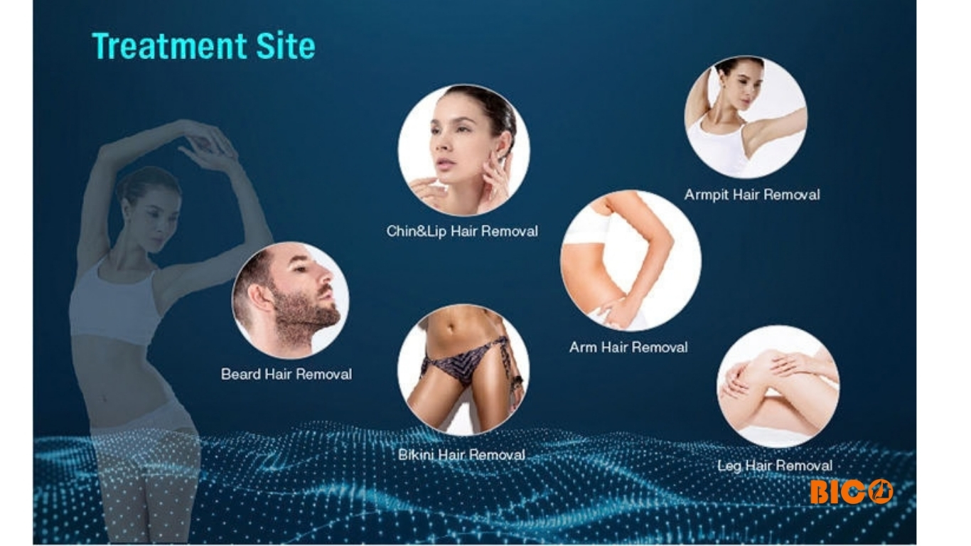 Máy triệt lông Diode LaserHR hãng&nbsp; DIMEI