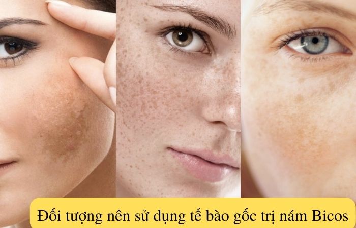 Làn da bị tình trạng nám, đốm đen nên sử dụng sản phẩm