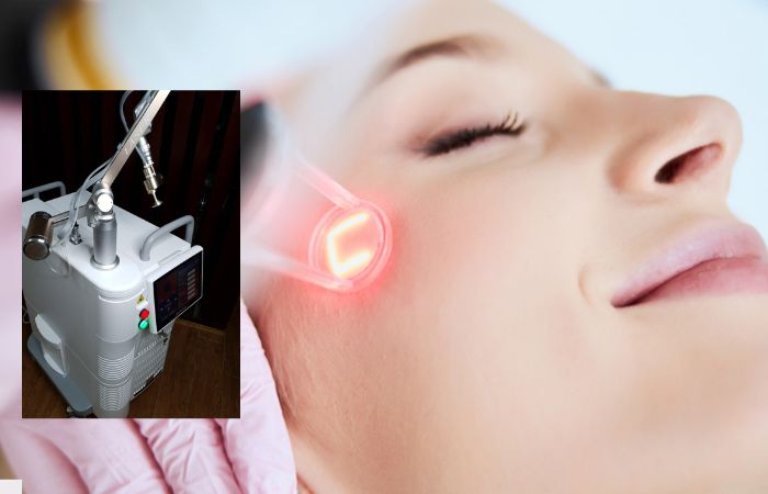 Thiết Bị Mỹ Phẩm BICO - Địa chỉ mua máy laser CO2 Fractional uy tín