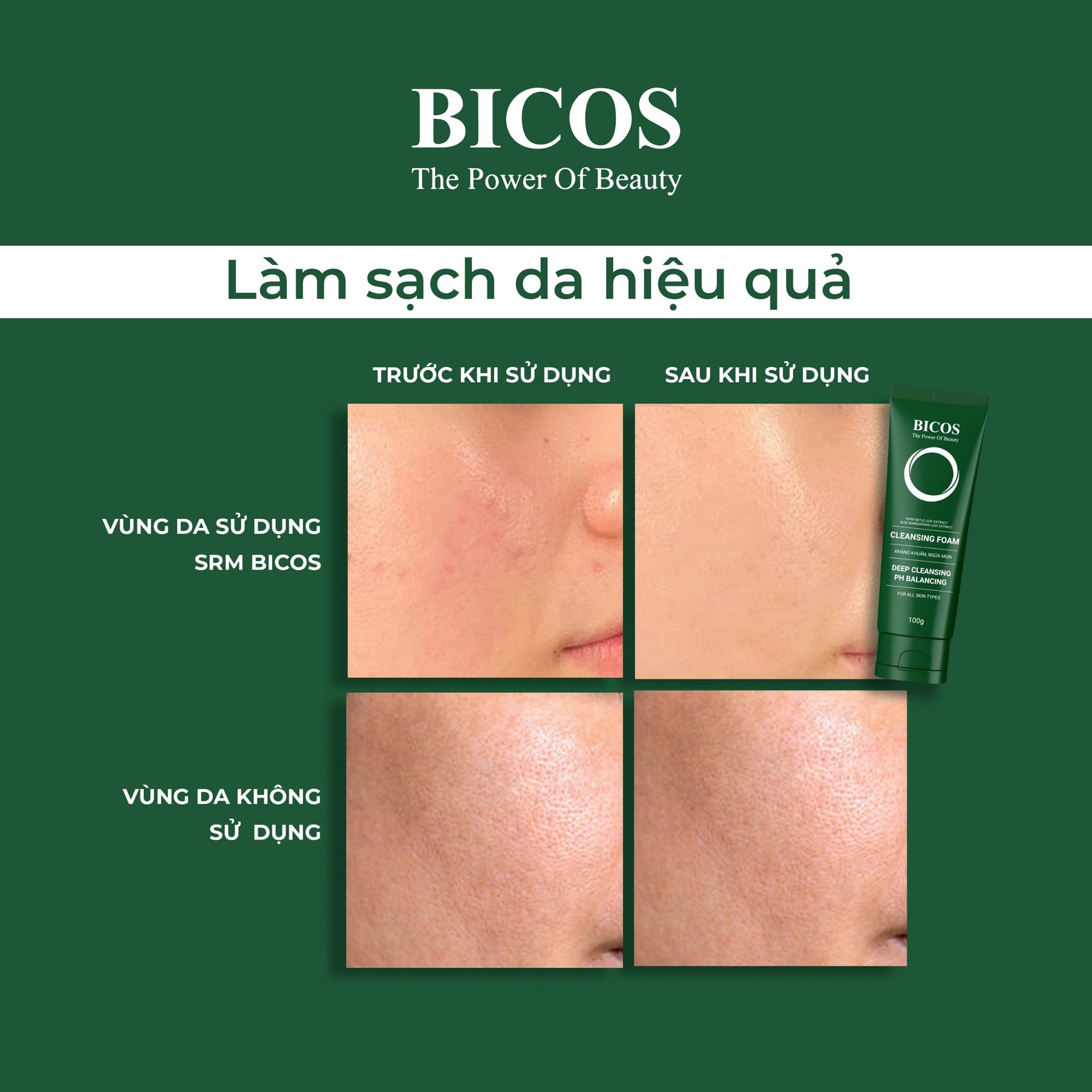 Hiệu quả làm sạch da khi sử dụng sản phẩm làm sạch BICOS