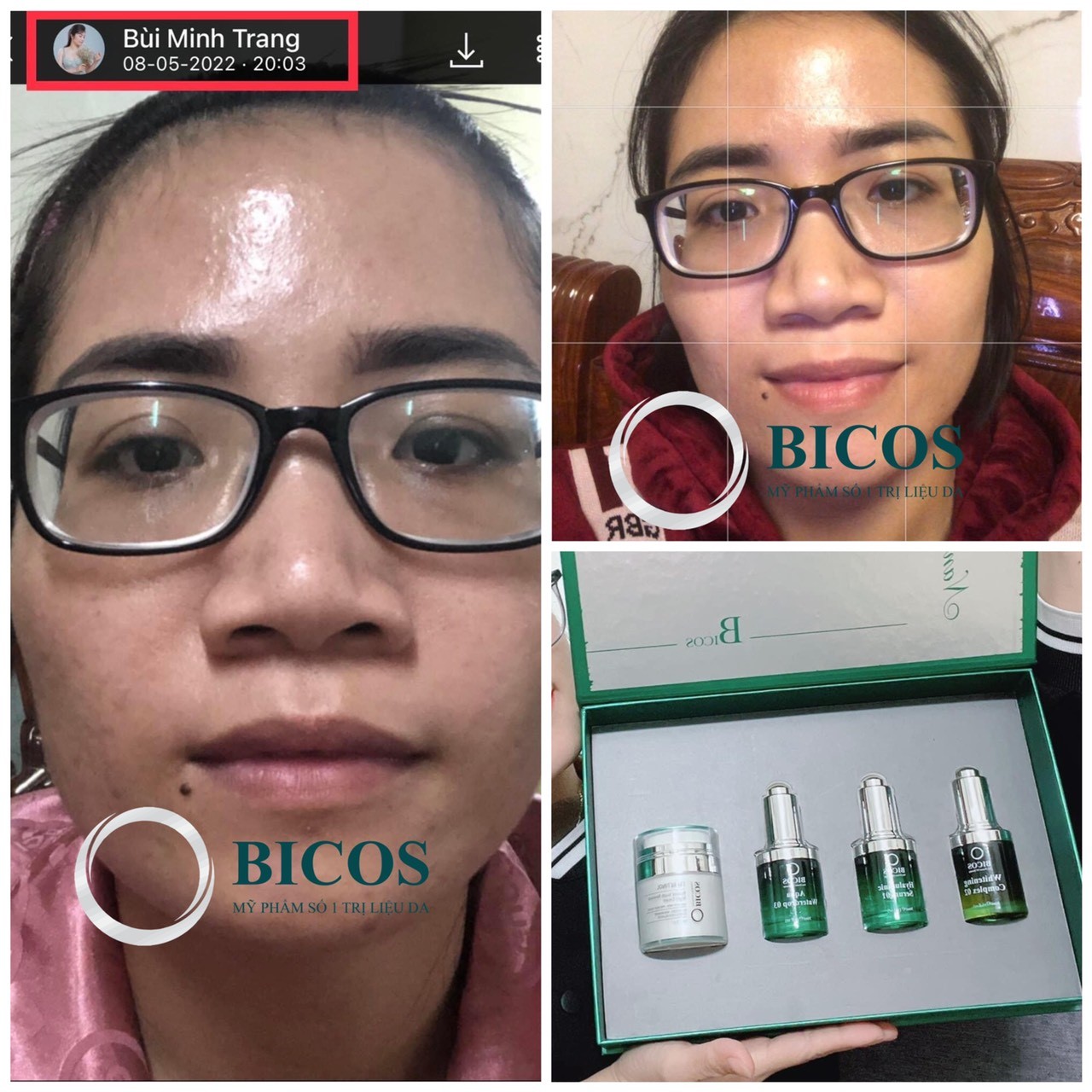 Bộ Sản Phẩm Nano Kim Cương Căng Bóng - Nano Diamond Bicos